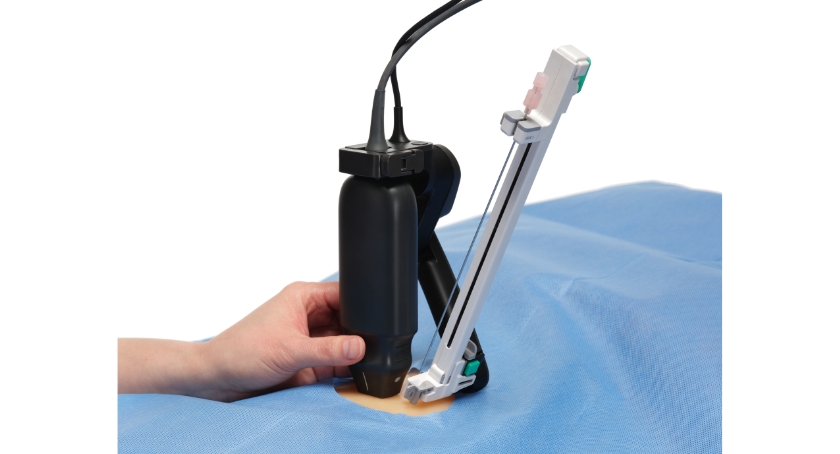 Mendaera Achieves 1st Procedures with Focalist Handheld Robotic System